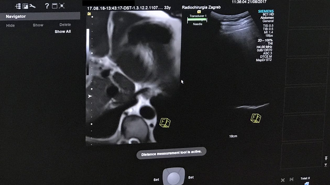 Pedeset nijansi prostate