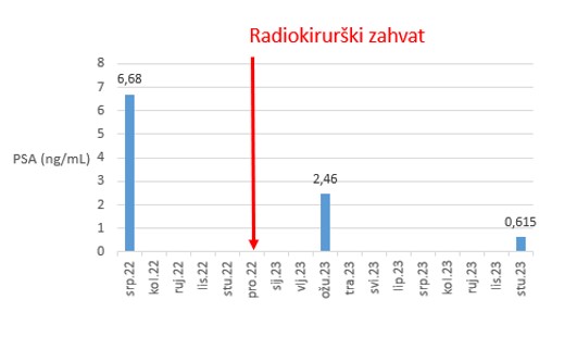 prostata ck55 4
